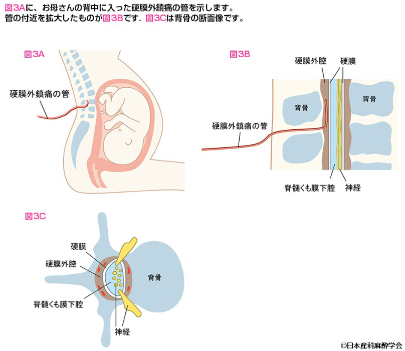 分娩室で赤ちゃんの心拍モニターを確認する助産師